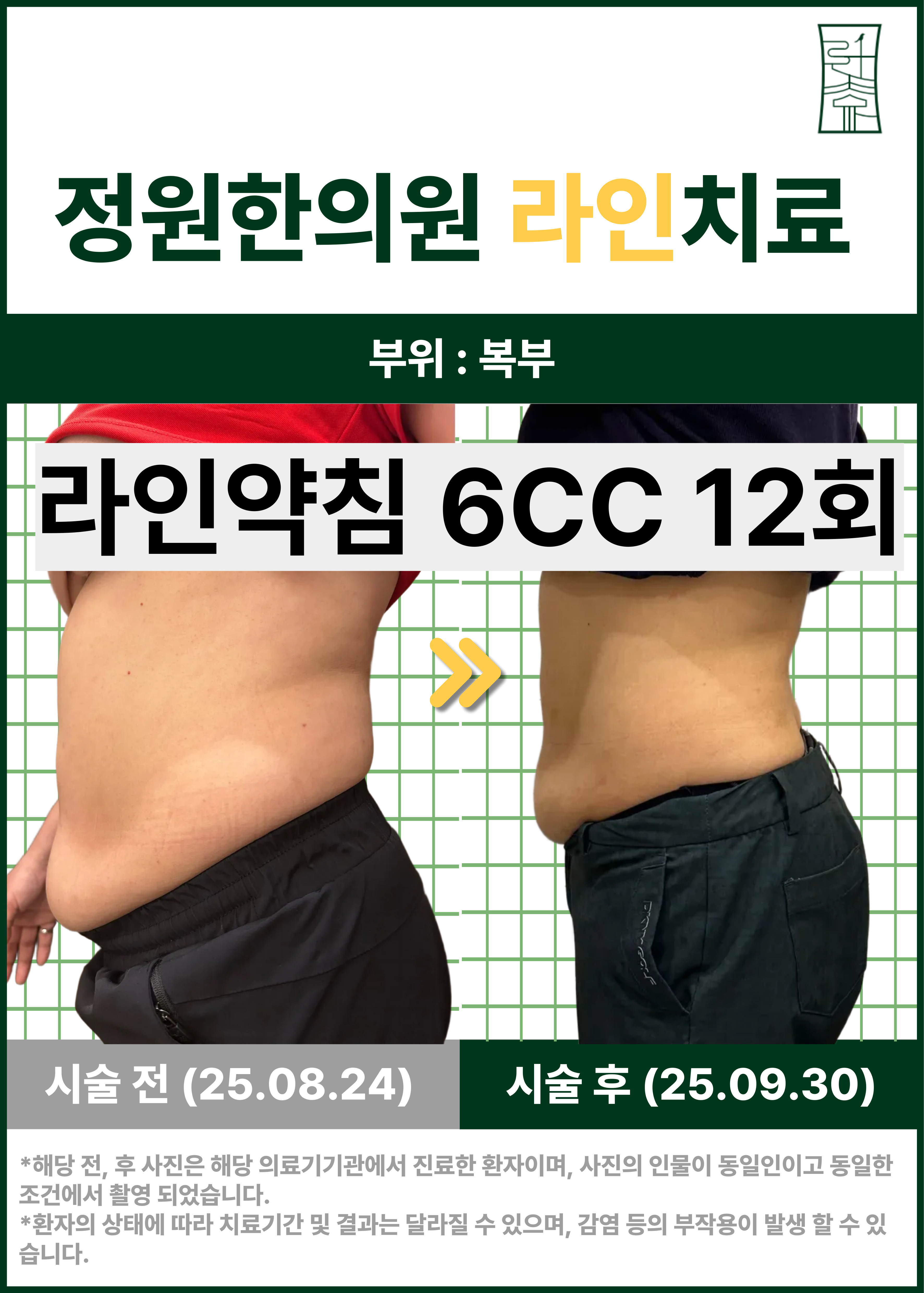 치료 전