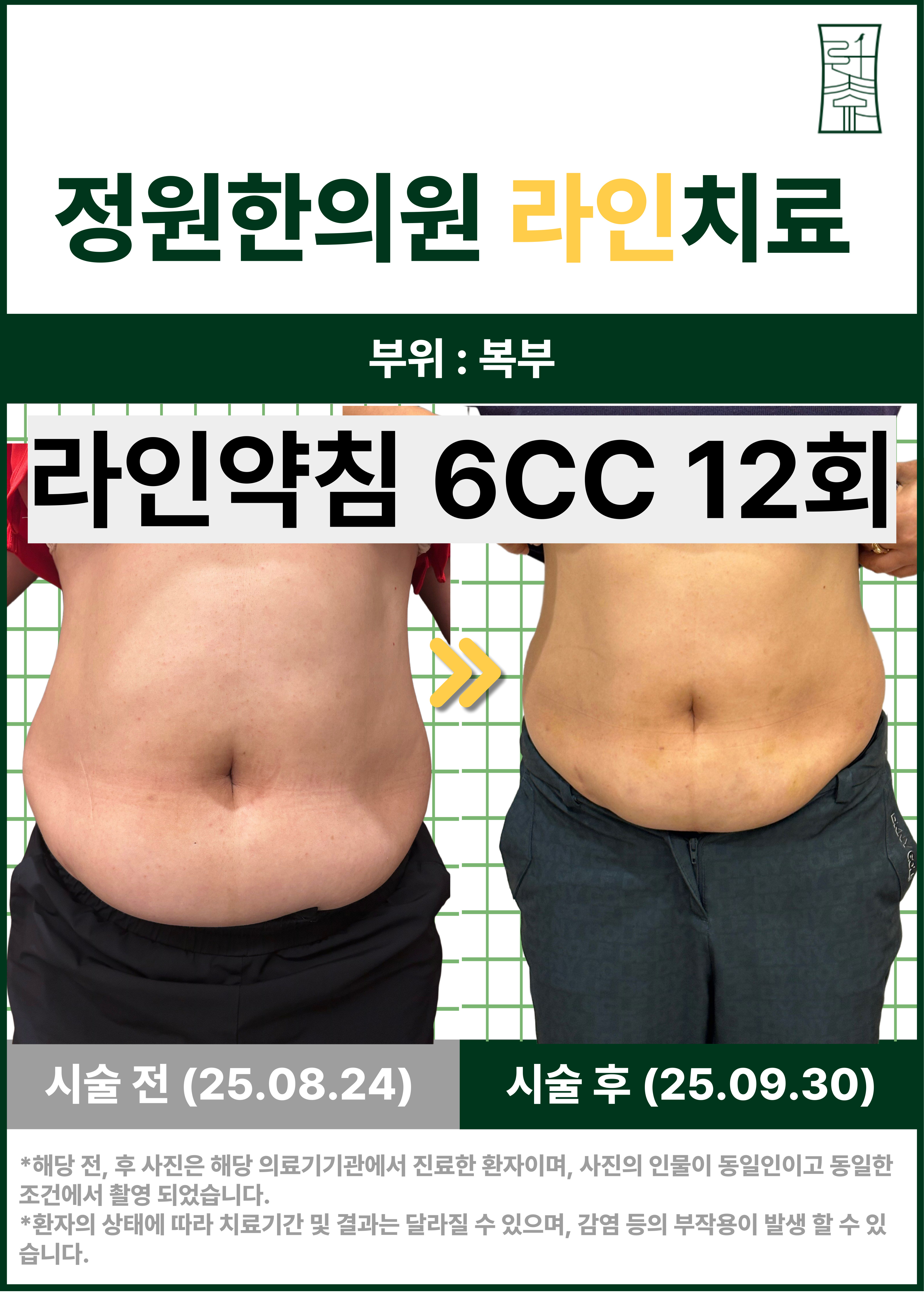 치료 전
