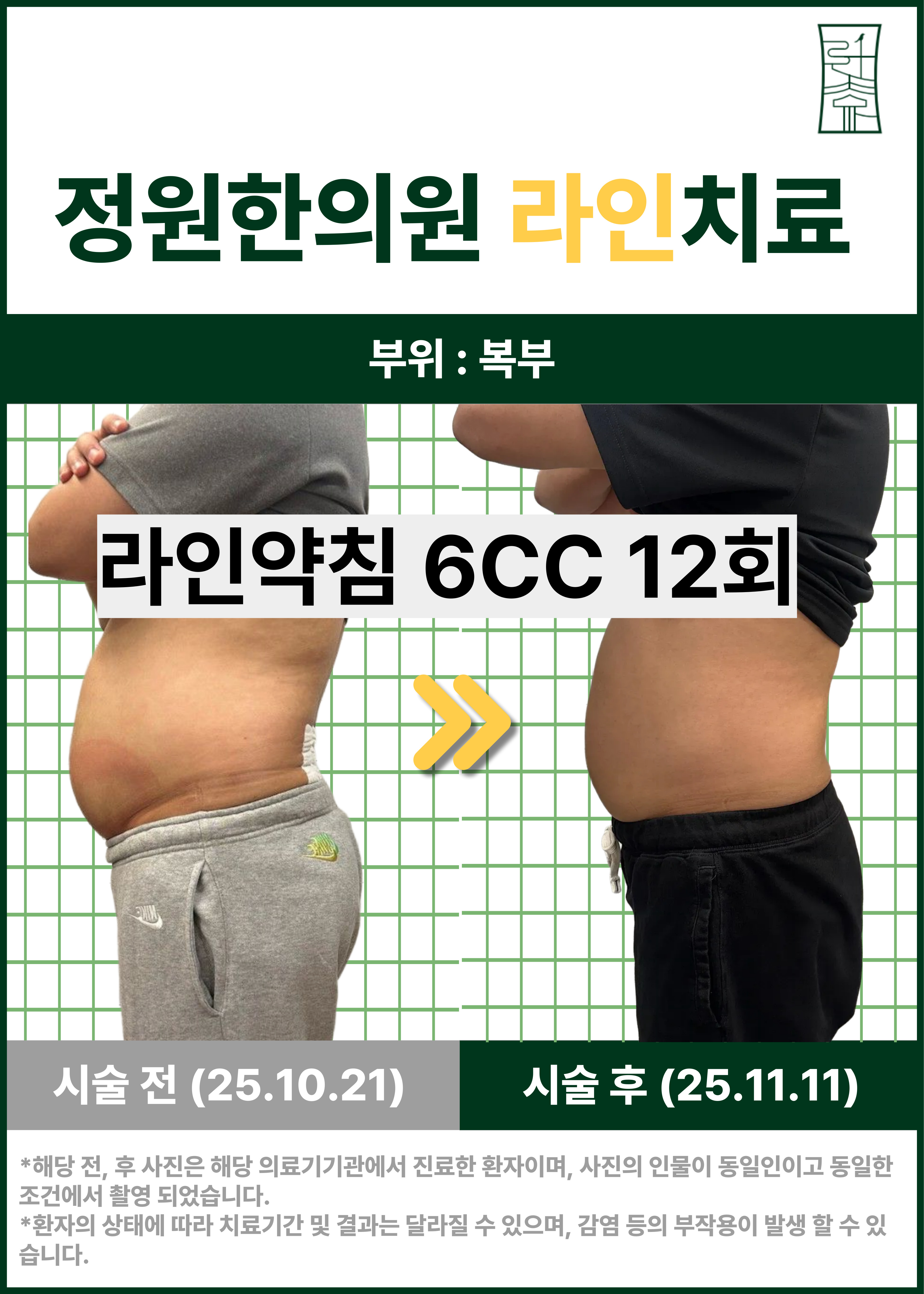 치료 전