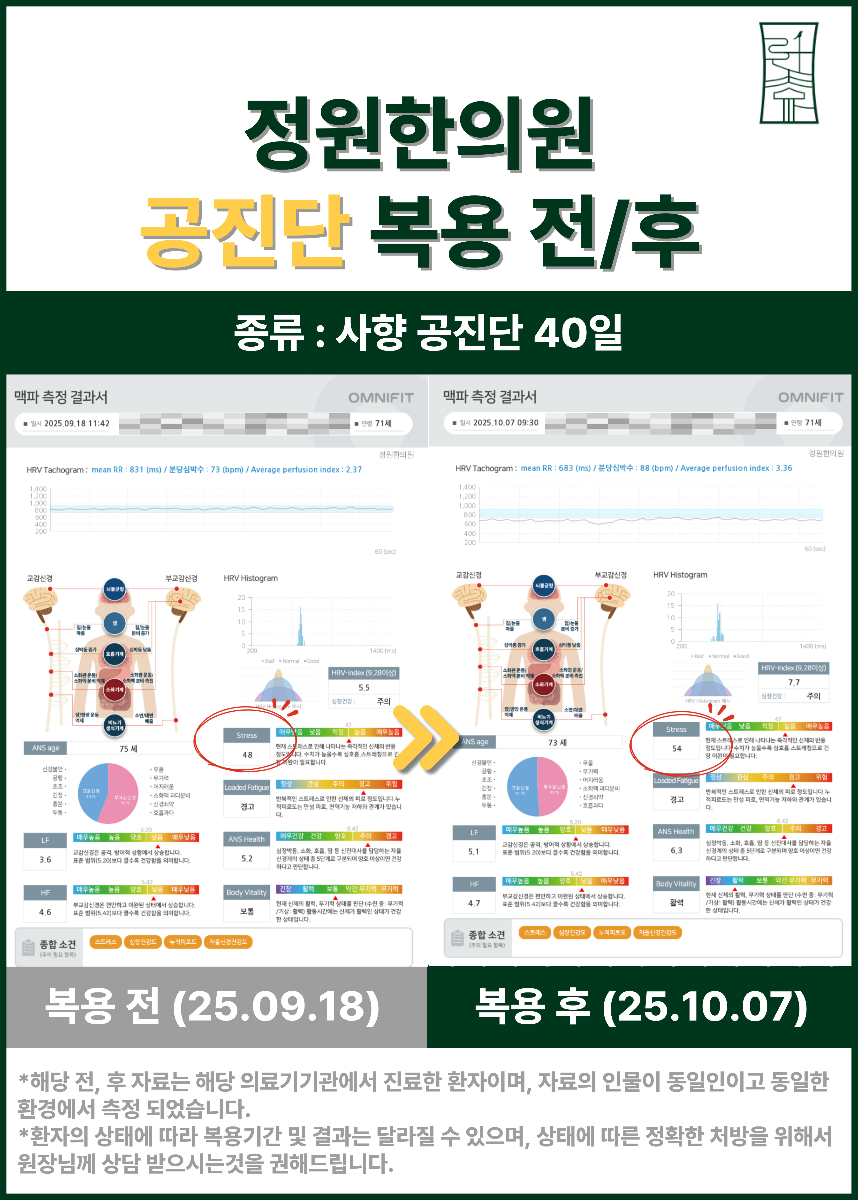 [70대/여성] 사향 공진단 40일 복용 후 뇌파 점수 향상 및 스트레스 개선 사례 치료 전