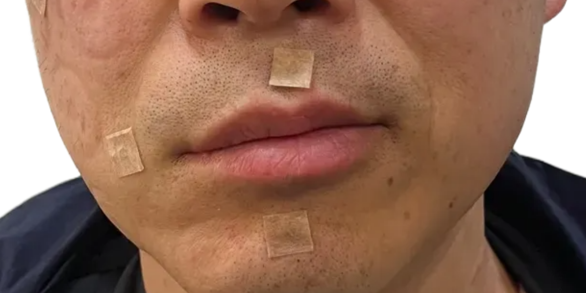 치료 전