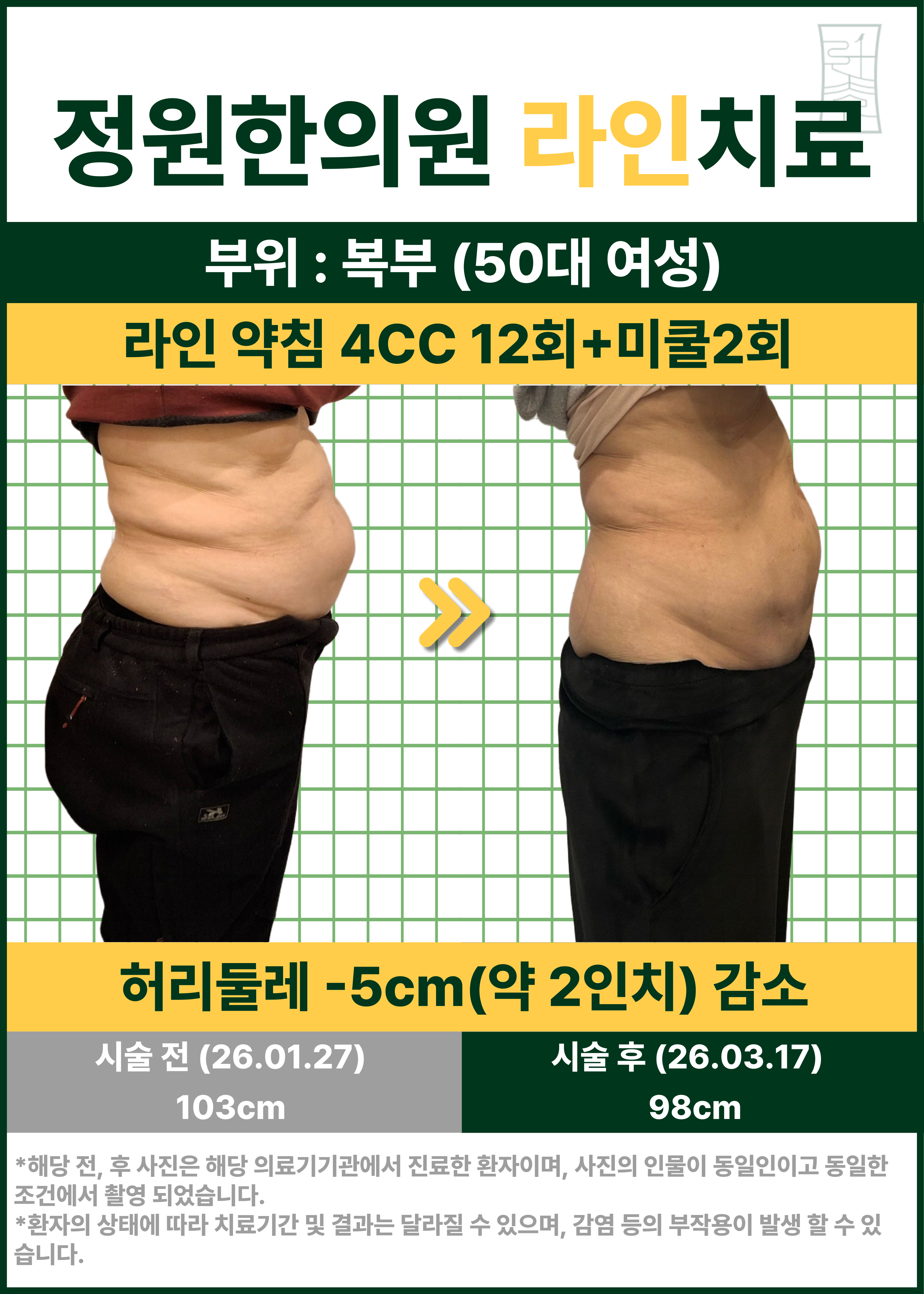 치료 전